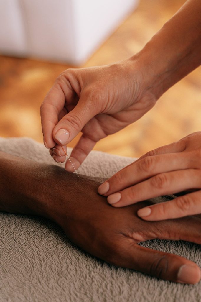 Acupuncturist gently placing a needle in a patient's hand