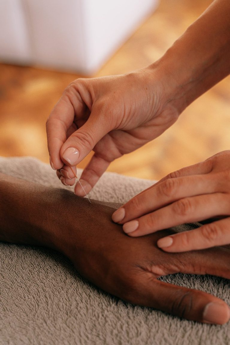 Acupuncturist gently placing a needle in a patient's hand